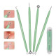 A set of cosmetology tools for removing acne, 4 pcs